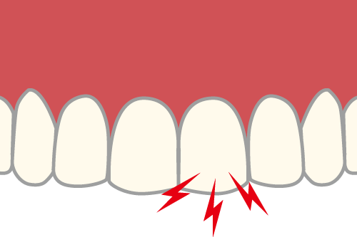 歯が痛むイメージ