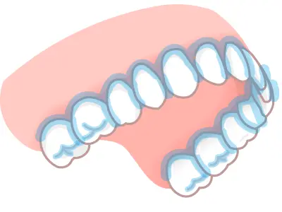 特に磨き残しやすい場所の図解