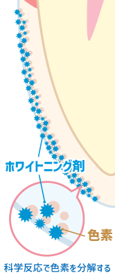 ホワイトニング剤の化学反応による色素の分解